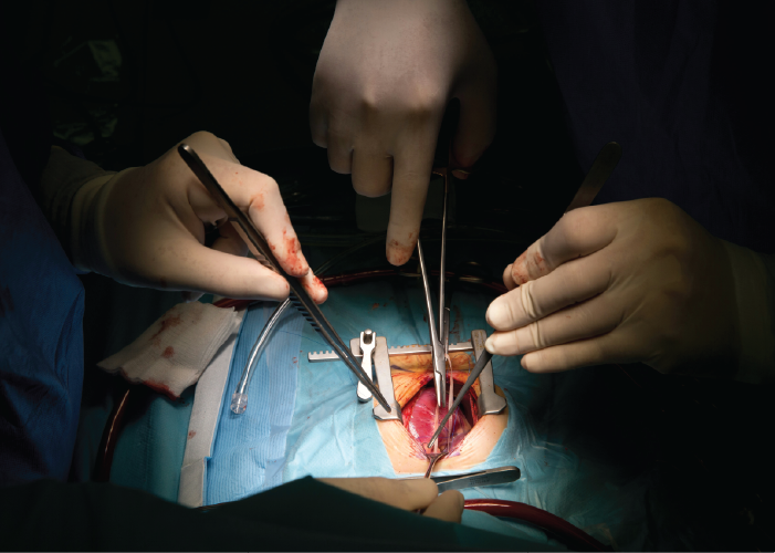Sheet Metical Fabrication in the Medical Industry - Surgical Tools By Adrian Sulyok